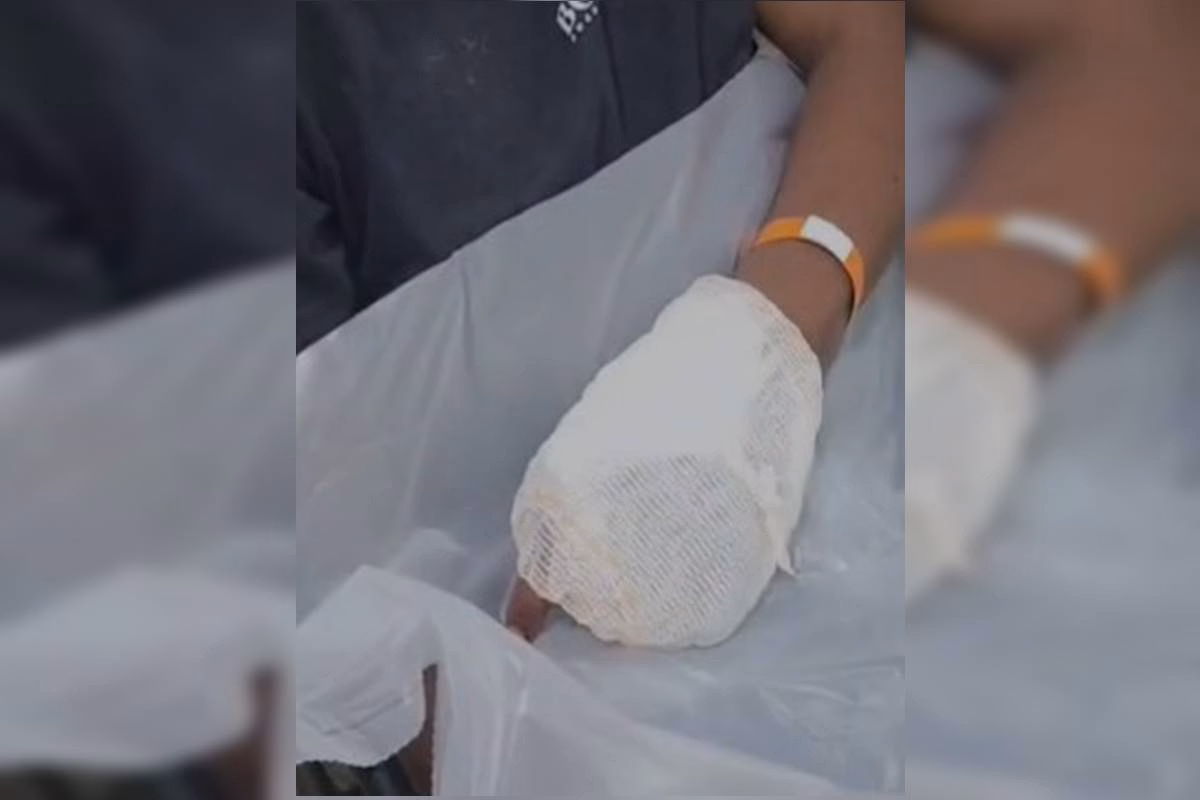Homem tem mão atingida ao tentar evitar disparo após briga com rival