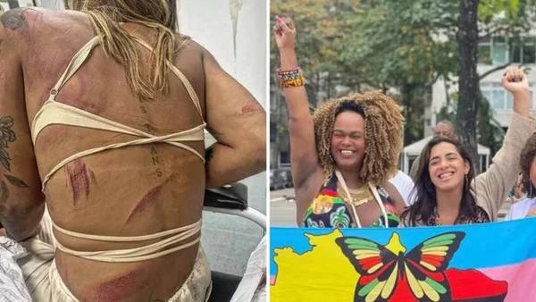 imagem colorida assessora benny briolly agredida rj