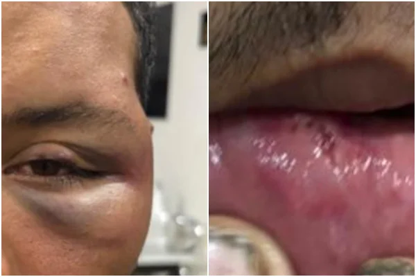 Petista é espancado em bar após revelar partido político