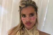 Tilly Whitfeld teve reação alérgica 