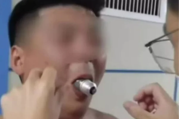 Na foto, um homem com uma lâmpada na boca - Metrópoles