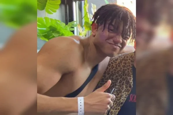 O jovem Harvey Edwards, de 19 anos, morreu em 28/6, três semanas após ser internado com uma grave crise de sinusite. O jovem teve se ser levado ao coma induzido para aliviar a pressão no cérebro que estava sofrendo, mas acabou não resistindo.