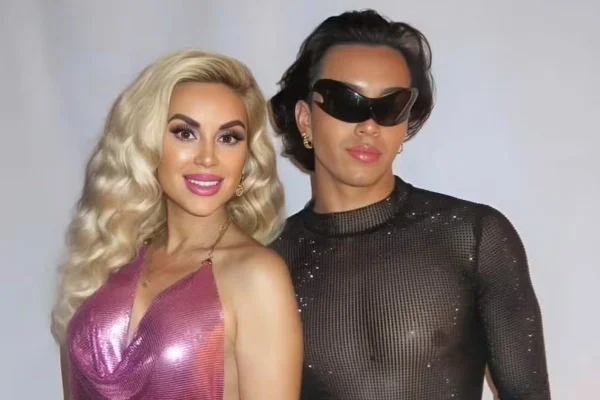 Barbie argentina revela tratamento bizarro que fará para rejuvenescer