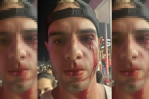Fotógrafo é agredido no Rock in Rio