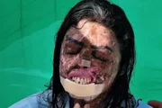 Karine Felipe, influenciadora que morreu de câncer após luta com doença rara Karine Felipe, influenciadora que morreu de câncer após luta com doença rara