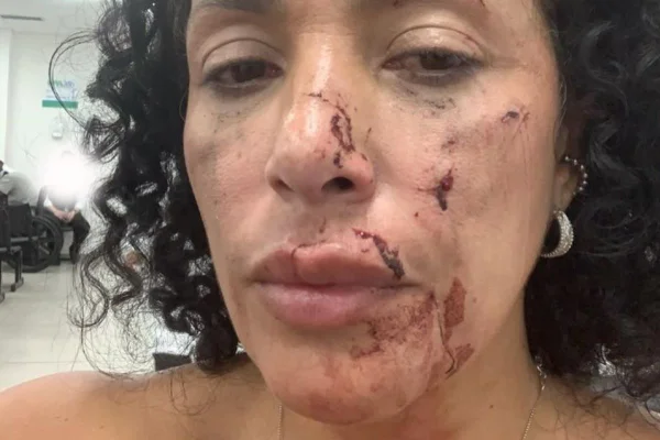 O Boteco Dona Tati, na Barra Funda, informou que houve um “episódio de briga generalizada”. A mulher alega que tomou uma garrafada no rosto - Metrópoles