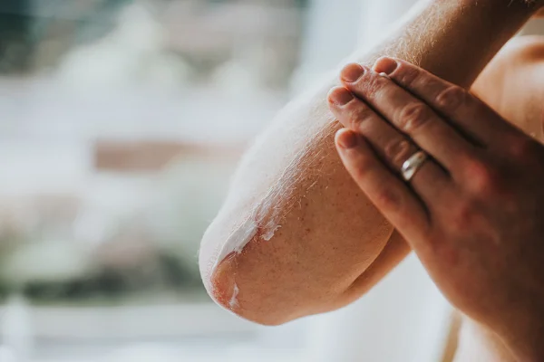 Loção hidratante esfregando masculina nos cotovelos e braços secos. Espaço para cópia.