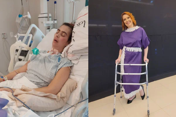 Imagem colorida de Doralice, que ficou um ano internada por Botulismo - Metrópoles
