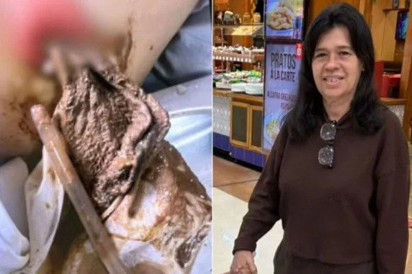 Imagem colorida mostra mulher branca vestida com uma blusa marrom e, ao lado dela, um pano que foi esquecido dentro do corpo dela após uma cirurgia - Metrópoles