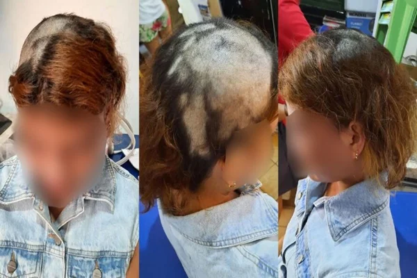 Mulher com partes da cabeça raspada