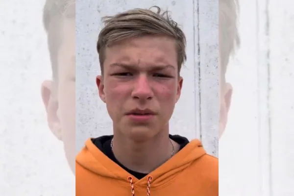 Artem Severiukhin pede desculpas por gesto nazista