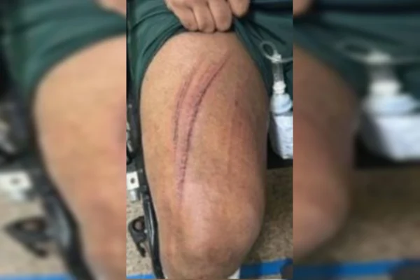 Garoto de programa relata momentos de terror em encontro com casal
