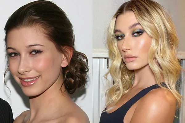 antes e depois da modelo Hailey Bieber