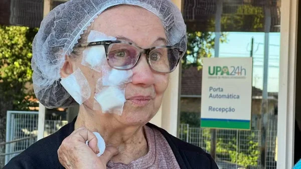 Vítima estava passeando com suas cachorrinhas em Rio Preto quando foi atacada por pitbull. Ela se recupera dos 50 pontos no rosto em casa - Metrópoles