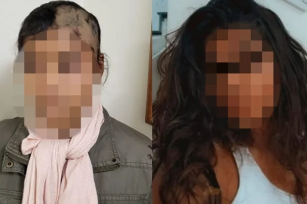 Bombeiro é acusado pela ex de raspar cabelo da filha por ciúmes