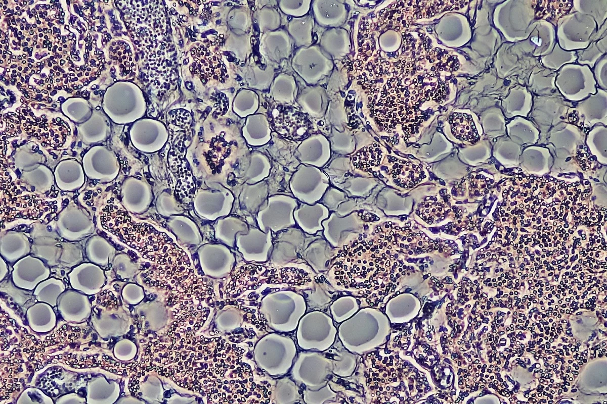 Estudo testa composto que faz corpo queimar gordura sem reduzir apetite