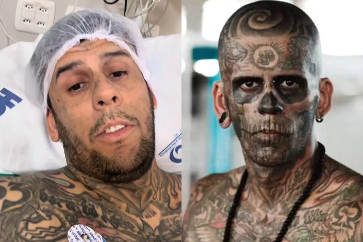 "Mais tatuado do Brasil", influenciador revela câncer maligno após cirurgia