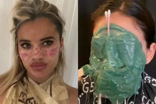 Relembre os 5 piores e mais perigosos truques de beleza do TikTok