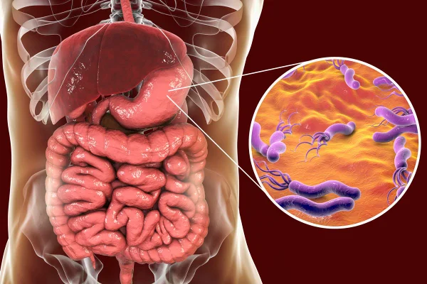 Foto colorida de sistema digestivo e uma lupa com a bactéria H. pylori - Metrópoles