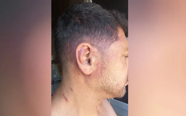 Homem denuncia agressão da PM ao procurar atendimento médico; vídeo
