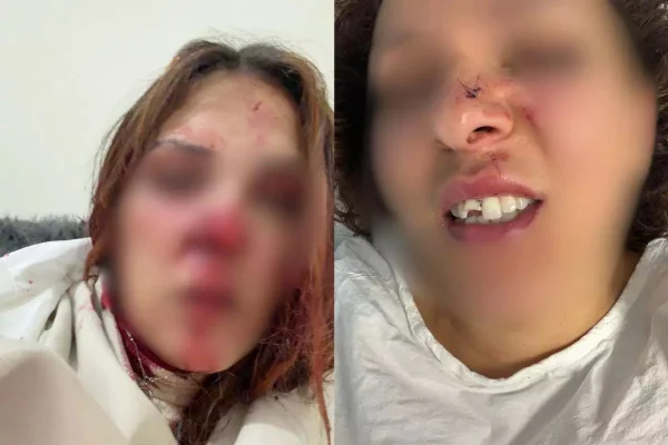 Sttefany Pires, de 33 anos, mora em Portugal. Após acusar o marido de violência doméstica, ele fugiu para Santos, no litoral de São Paulo - Metrópoles