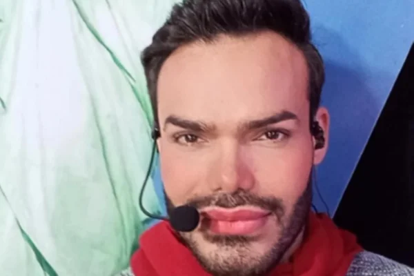 'Ken venezuelano' morre aos 41 anos após uso excessivo de testosterona