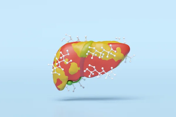 Ilustração mostra um fígado cheio de gordura e com moléculas de glicose - Metrópoles