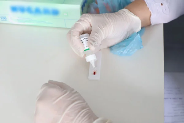 Teste de HIV