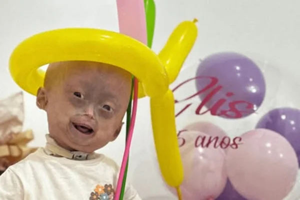 Mãe de Elis, influencer mirim com síndrome rara, lamenta morte. Veja