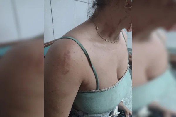 Homem espanca esposa após ser flagrado beijando outra mulher