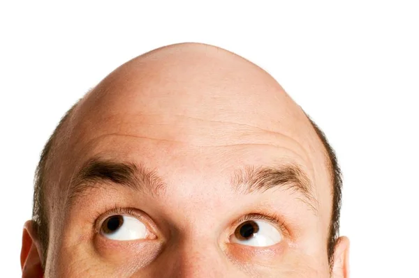 Congresso de dermatologia defende finasterida em creme para calvície