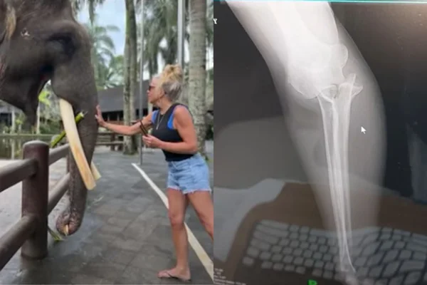Turista tem braço fraturado após ser mordida por elefante em viagem