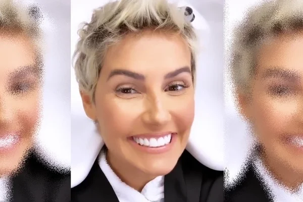 Deborah Secco assusta fãs após fazer clareamento dental: “Ken Humano”