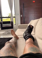 Anderson Neiff mostrou o pé machucado Anderson Neiff mostrou o pé machucado