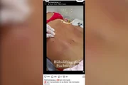 Clínica no RJ é denunciada por lipo irregular e rebate: “Ninguém morreu” - imagem 4