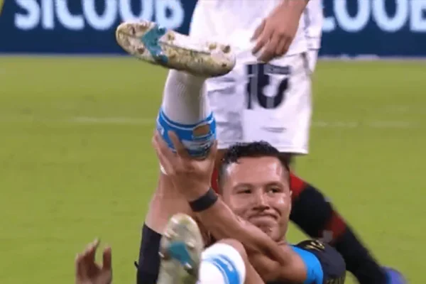 Marlon com a perna quebrada em partida entre Grêmio x Vitória