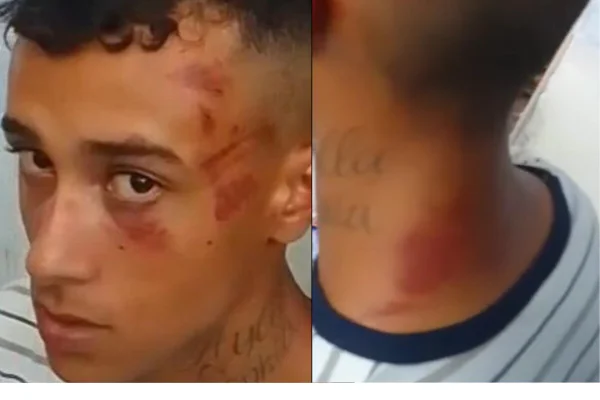 Jovem com hematomas no rosto e nuca - Metrópoles