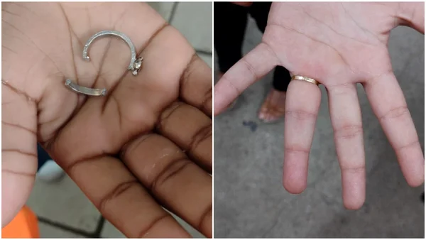 Anel preso no dedo: dois casos em um dia mobilizam bombeiros em MG