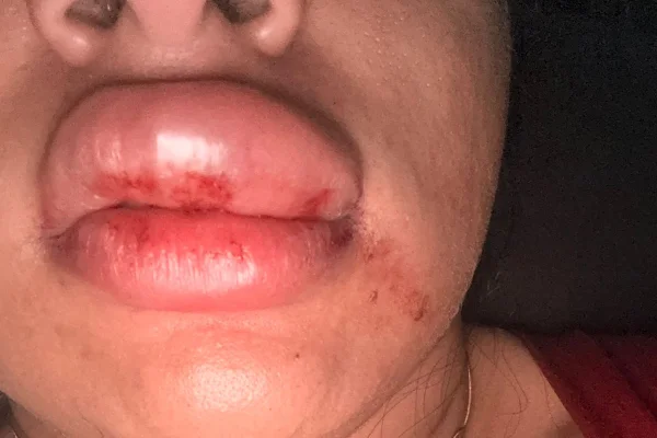 Tapas, socos e enforcamento: vereador é denunciado por agredir mulher