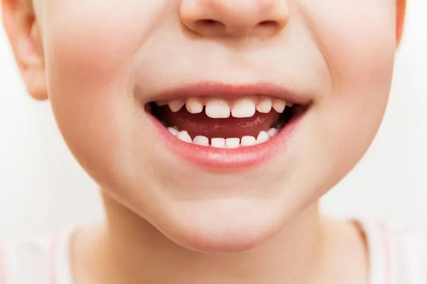 Como devemos cuidar dos dentinhos dos nossos filhos?