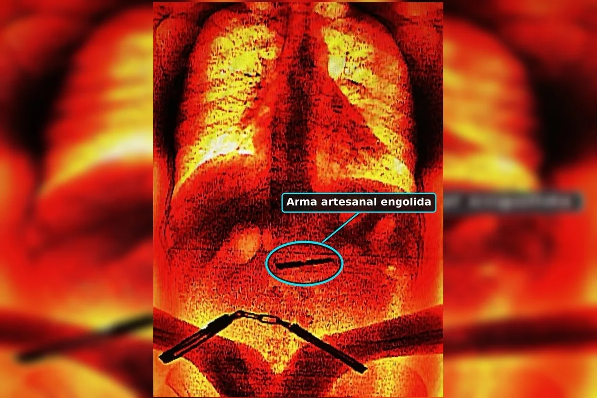 Um detento engoliu uma faca artesanal Um detento engoliu uma faca artesanal