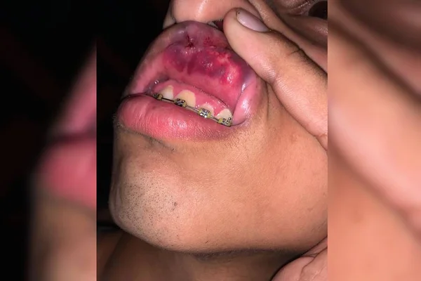 Jovens espancados por PMs no DF