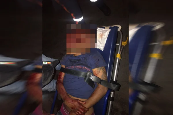 Imagens fortes: após discussão em bar, homem leva socos e fica com rosto desfigurado