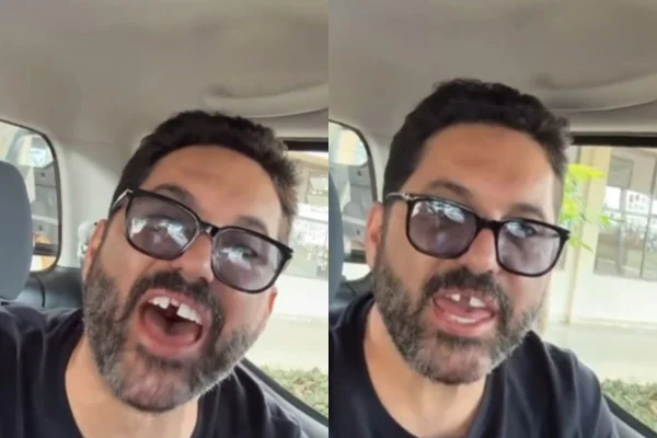 Sertanejo Edson, dupla de Hudson, perde dente antes de show e faz piada
