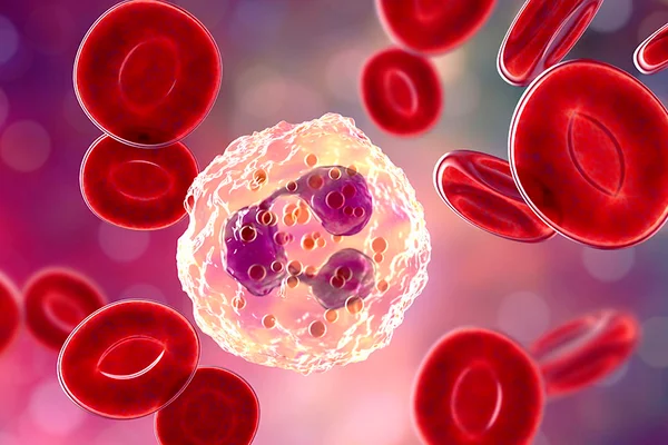 Obesos e diabéticos tipo 2 têm mais chance de desenvolver infecções