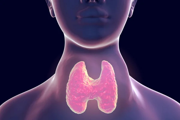 Imagem de corpo humano mostra nódulos na tireoide e pescoço inchado. A tireoide é representada na cor lilás-Metrópoles