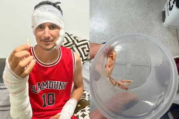 imagem colorida homem sobrevive ataque onça