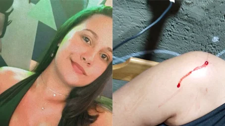RJ: “Fiquei de boa”, diz jovem baleada que não percebeu ferimento