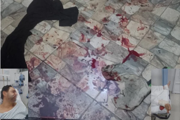 Foto colorida de chão de azulejos brancos e cinjas manchados com sangue - Metrópoles
