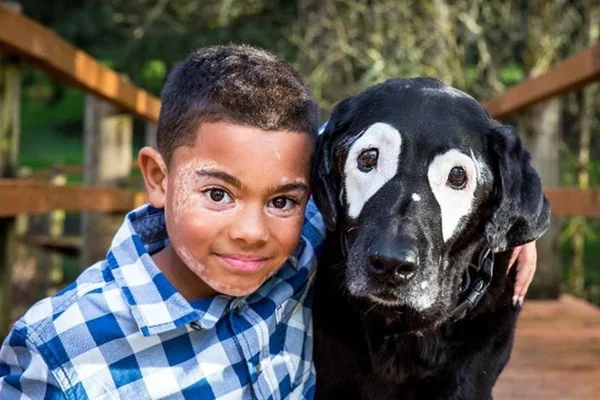 Menino sai da depressão ao conhecer cachorro com a mesma doença que ele
